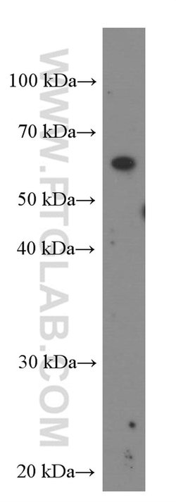 IL21R Mouse anti-Human, Clone: 1D1C2, Proteintech:Antibodies:Primary Antibodies