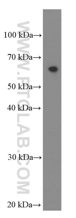 IL21R Mouse anti-Human, Clone: 1D1C2, Proteintech:Antibodies:Primary Antibodies