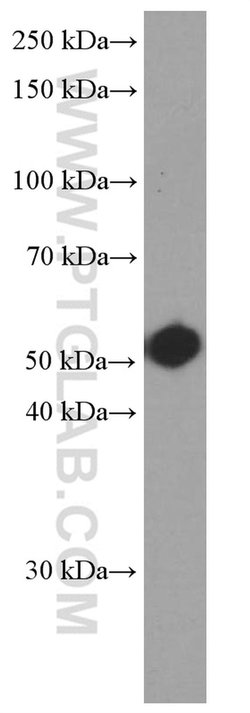 Fascin Mouse anti-Human, Clone: 1B5G3, Proteintech 20 &mu;L | Buy Online | Proteintech | Fisher Scientific