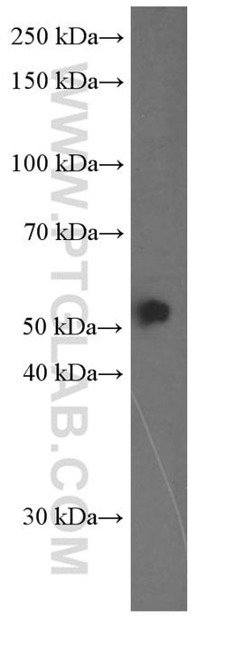 Fascin Mouse anti-Human, Clone: 1B5G3, Proteintech 20 &mu;L | Buy Online | Proteintech | Fisher Scientific