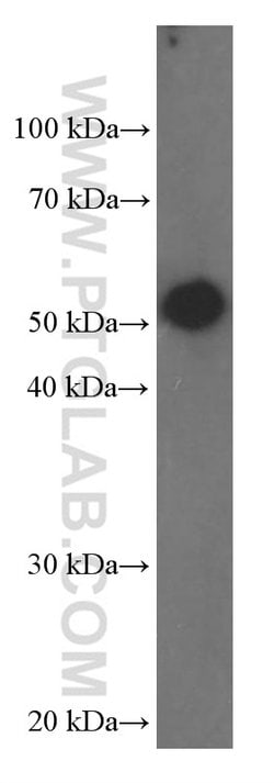 Fascin Mouse anti-Human, Clone: 1B5G3, Proteintech 20 &mu;L | Buy Online | Proteintech | Fisher Scientific