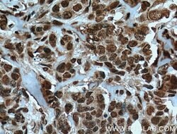 TRIM24 Mouse anti-Human, Mouse, Clone: 1D6D9, Proteintech:Antibodies:Primary
