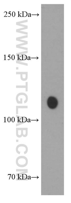 TRIM24 Mouse anti-Human, Mouse, Clone: 1D6D9, Proteintech:Antibodies:Primary