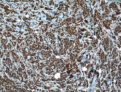 TRIM24 Mouse anti-Human, Mouse, Clone: 1D6D9, Proteintech:Antibodies:Primary