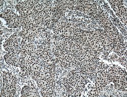 TRIM24 Mouse anti-Human, Mouse, Clone: 1D6D9, Proteintech:Antibodies:Primary