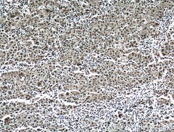 TRIM24 Mouse anti-Human, Mouse, Clone: 1D6D9, Proteintech:Antibodies:Primary