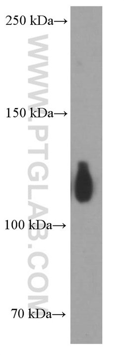 TRIM24 Mouse anti-Human, Mouse, Clone: 1D6D9, Proteintech:Antibodies:Primary