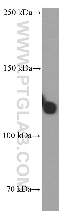 TRIM24 Mouse anti-Human, Mouse, Clone: 1D6D9, Proteintech:Antibodies:Primary