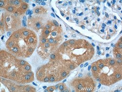 VPS37A Mouse anti-Human, Clone: 1F9A4, Proteintech 150 &mu;L; Unconjugated:Antibodies,