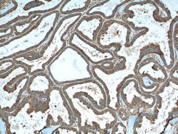 VPS37A Mouse anti-Human, Clone: 1F9A4, Proteintech 150 &mu;L; Unconjugated:Antibodies,