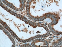 VPS37A Mouse anti-Human, Clone: 1F9A4, Proteintech 150 &mu;L; Unconjugated:Antibodies,