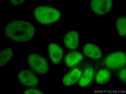 Proteintech Group Inc NUDT21 Mouse anti-Human, Mouse, Clone: 1C4C8, Proteintech