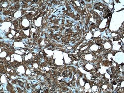 MMP3 Mouse anti-Human, Mouse, Porcine, Rat, Clone: 1F5A9, Proteintech:Antibodies:Primary