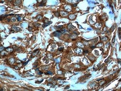 MMP3 Mouse anti-Human, Mouse, Porcine, Rat, Clone: 1F5A9, Proteintech:Antibodies:Primary