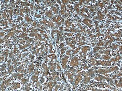 MMP3 Mouse anti-Human, Mouse, Porcine, Rat, Clone: 1F5A9, Proteintech:Antibodies:Primary