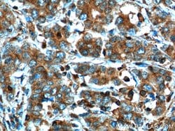 MMP3 Mouse anti-Human, Mouse, Porcine, Rat, Clone: 1F5A9, Proteintech:Antibodies:Primary