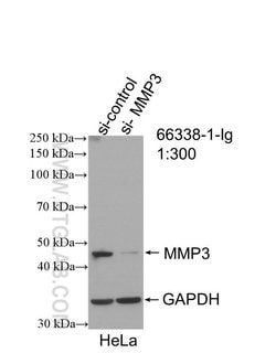 MMP3 Mouse anti-Human, Mouse, Porcine, Rat, Clone: 1F5A9, Proteintech:Antibodies:Primary
