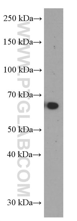 MMP3 Mouse anti-Human, Mouse, Porcine, Rat, Clone: 1F5A9, Proteintech:Antibodies:Primary