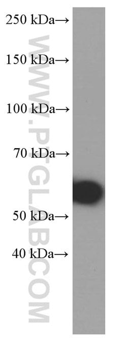 MMP3 Mouse anti-Human, Mouse, Porcine, Rat, Clone: 1F5A9, Proteintech