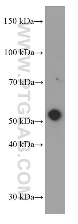 MMP3 Mouse anti-Human, Mouse, Porcine, Rat, Clone: 1F5A9, Proteintech:Antibodies:Primary