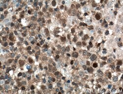 BCL6 Mouse anti-Human, Clone: 1E6B1, Proteintech 150 &mu;L; Unconjugated:Antibodies,