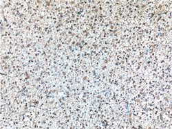 PHF10 Mouse anti-Human, Mouse, Clone: 4D4C6, Proteintech 150 &mu;L | Buy Online | Proteintech Group Inc | Fisher Scientific