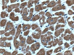 CLIC4 Mouse anti-Human, Porcine, Rat, Clone: 1B7F9, Proteintech:Antibodies:Primary