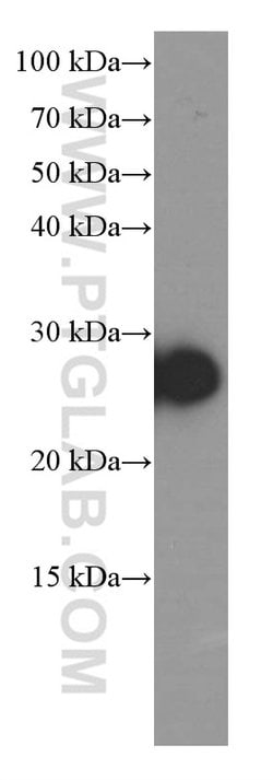 Dermatopontin Mouse anti-Human, Rat, Clone: 4B1A12, Proteintech:Antibodies:Primary