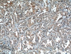 COX2/ Cyclooxygenase 2 Mouse anti-Human, Mouse, Clone: 3G2B9, Proteintech