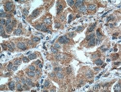 COX2/ Cyclooxygenase 2 Mouse anti-Human, Mouse, Clone: 3G2B9, Proteintech