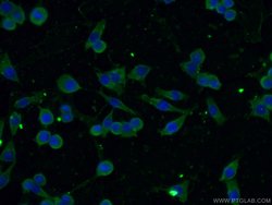 CBLB Mouse anti-Human, Mouse, Porcine, Rat, Clone: 2D3A2, Proteintech 150