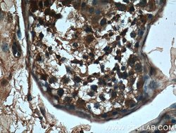 CBLB Mouse anti-Human, Mouse, Porcine, Rat, Clone: 2D3A2, Proteintech 150