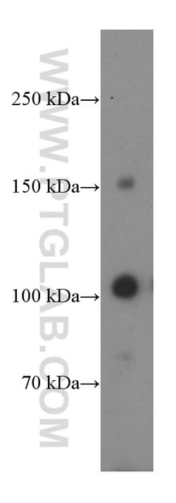 CBLB Mouse anti-Human, Mouse, Porcine, Rat, Clone: 2D3A2, Proteintech 150