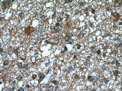 BRE Mouse anti-Human, Mouse, Rat, Clone: 2E5A5, Proteintech:Antibodies:Primary