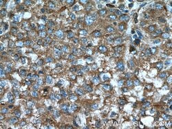 D2HGDH Mouse anti-Human, Mouse, Clone: 1E9B3, Proteintech 150 &mu;L; Unconjugated:Antibodies,