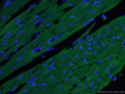 Cardiac Troponin I Mouse anti-Human, Mouse, Rat, Clone: 1D5D6, Proteintech:Anticuerpos:Anticuerpos