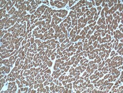 Cardiac Troponin I Mouse anti-Human, Mouse, Rat, Clone: 1D5D6, Proteintech:Anticuerpos:Anticuerpos
