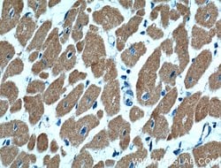 Cardiac Troponin I Mouse anti-Human, Mouse, Rat, Clone: 1D5D6, Proteintech:Anticuerpos:Anticuerpos