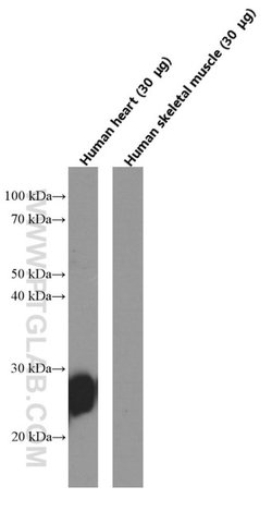 Cardiac Troponin I Mouse anti-Human, Mouse, Rat, Clone: 1D5D6, Proteintech:Anticuerpos:Anticuerpos