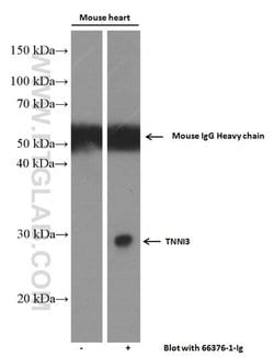 Cardiac Troponin I Mouse anti-Human, Mouse, Rat, Clone: 1D5D6, Proteintech:Anticuerpos:Anticuerpos
