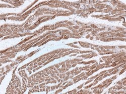 Cardiac Troponin I Mouse anti-Human, Mouse, Rat, Clone: 1D5D6, Proteintech:Anticuerpos:Anticuerpos