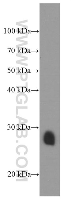 Cardiac Troponin I Mouse anti-Human, Mouse, Rat, Clone: 1D5D6, Proteintech:Anticuerpos:Anticuerpos