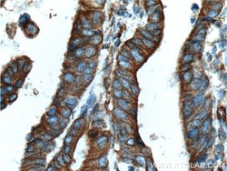 Occludin Mouse anti-Human, Mouse, Porcine, Rat, Clone: 1D3C4, Proteintech:Antibodies:Primary