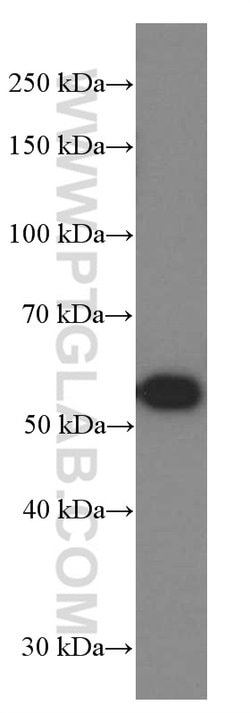 NAMPT/PBEF Mouse anti-Human, Mouse, Rat, Clone: 3D4D8, Proteintech 150