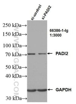 PADI2 Mouse anti-Human, Mouse, Rat, Clone: 2D8C12, Proteintech 150 &mu;L;