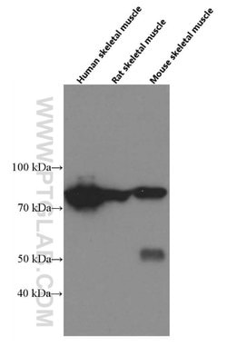 PADI2 Mouse anti-Human, Mouse, Rat, Clone: 2D8C12, Proteintech 150 &mu;L;