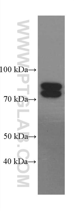 PADI2 Mouse anti-Human, Mouse, Rat, Clone: 2D8C12, Proteintech 150 &mu;L;