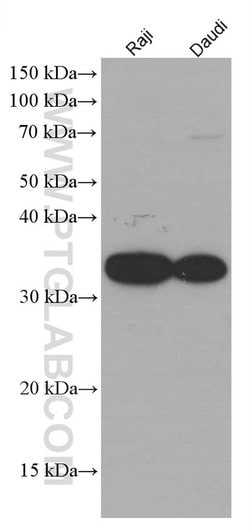 CD74 Mouse anti-Human, Clone: 2D8A1, Proteintech:Antibodies:Primary Antibodies