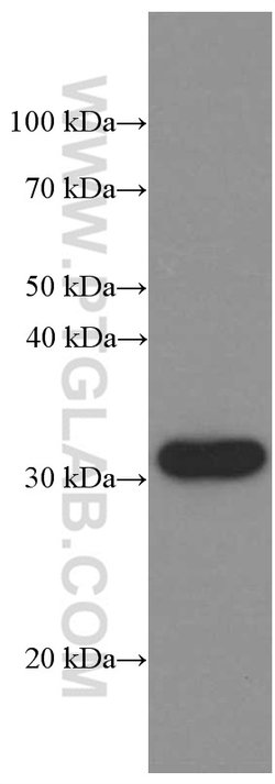 CD74 Mouse anti-Human, Clone: 2D8A1, Proteintech:Antibodies:Primary Antibodies