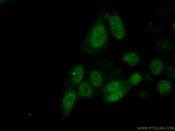 Cyclin A2 Mouse anti-Human, Clone: 1C6C11, Proteintech:Antibodies:Primary